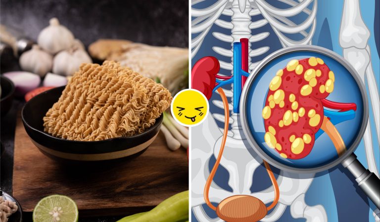 Daftar Makanan Perusak Ginjal yang Sering Dianggap Sepele, Nomor 6 Favorit Banyak Orang Indonesia!