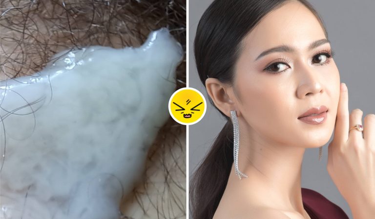 Skincare Tak Biasa: Sperma Suami Dipakai di Wajah, Ini Kata Ahli Kesehatan